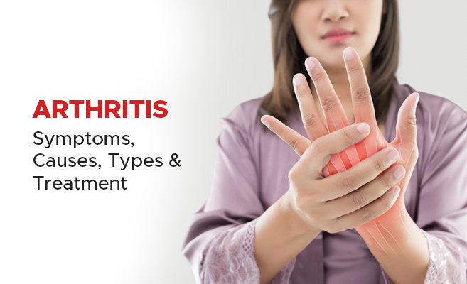 Arthritis Treatment